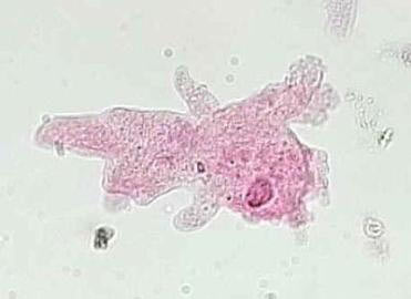 reino protista - protozoarios - rhizopoda reino protista - protozoarios - rhizopoda