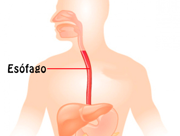 Se cura el cáncer de esófago